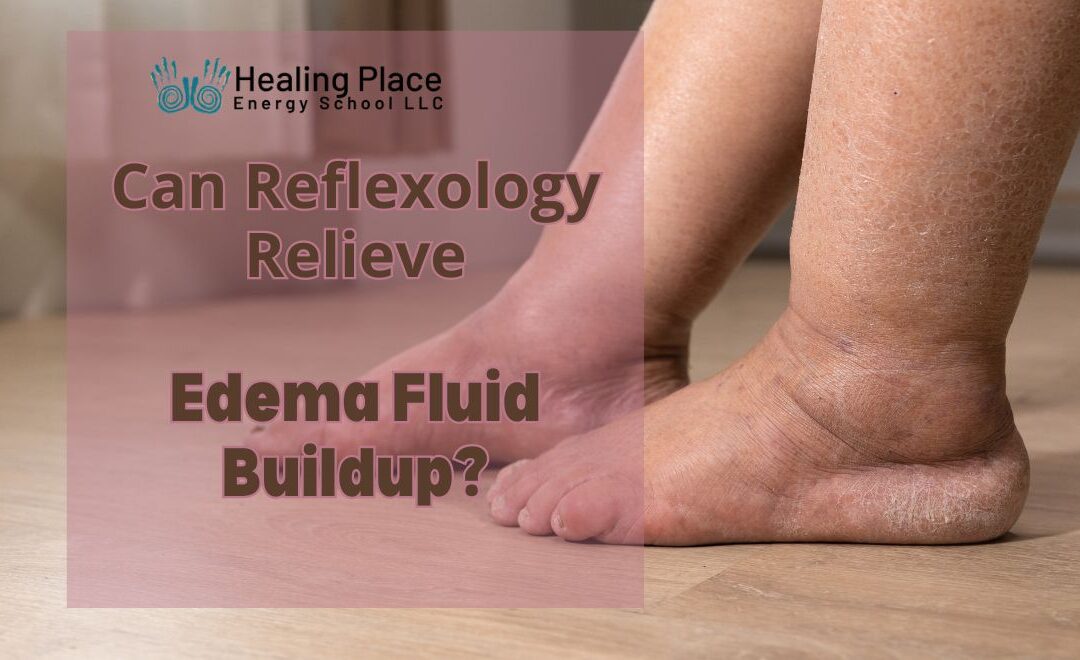 Can Reflexology Relieve #Edema Fluid Buildup? #kidneystones #painrelief #HealingPlaceEnergySchool #ReflexologyNearMe