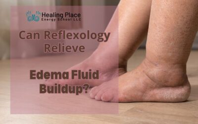 Can Reflexology Relieve #Edema Fluid Buildup? #kidneystones #painrelief #HealingPlaceEnergySchool #ReflexologyNearMe